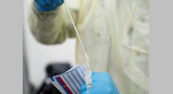 India places orders for 6.3 million RT-PCR test kits
