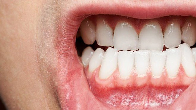 Gum disease may up mouth, stomach cancer risk: Study