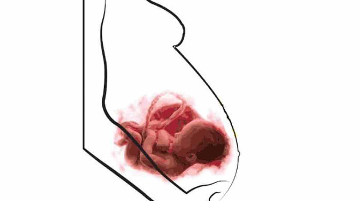 President Kovind gives assent to Surrogacy (Regulation) Act, 2021