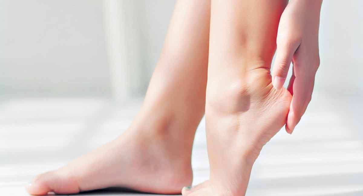 Cracked heels? Try these tips