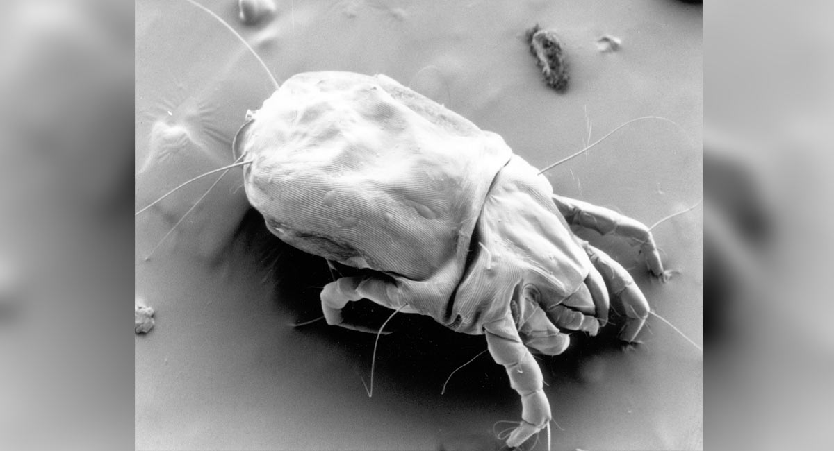 Research finds mites live on skin of human’s face and mate at night