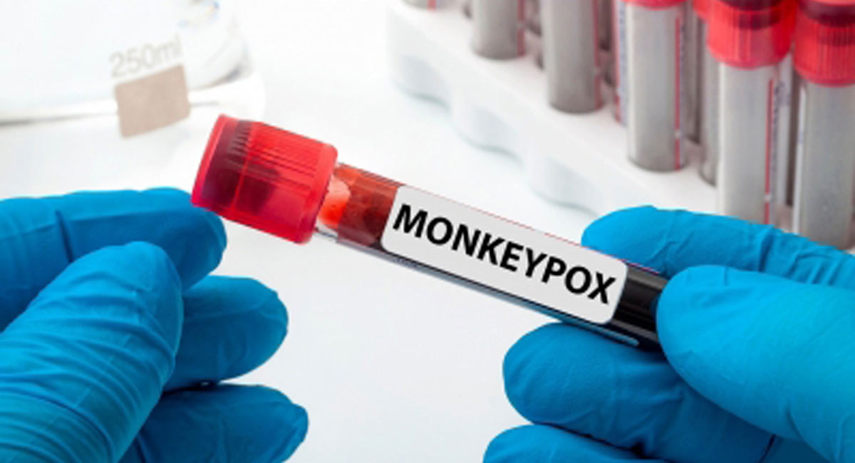 Delhi reports first monkeypox case