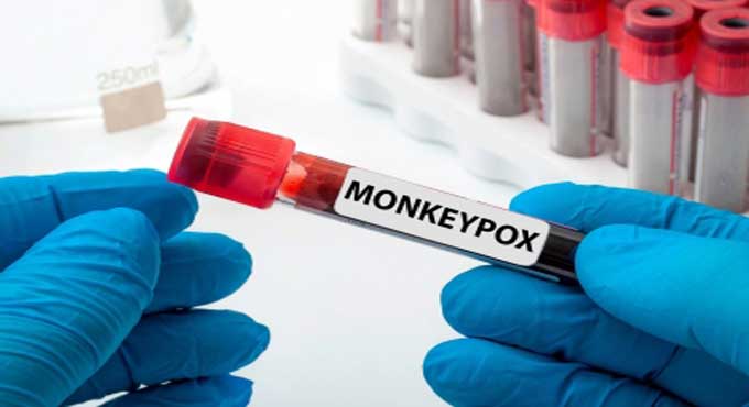 Canada confirms 604 cases of monkeypox