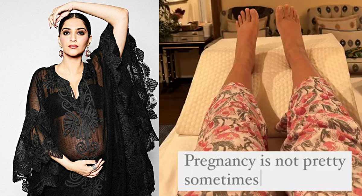 Pregnancy is not pretty sometimes: Sonam Kapoor shares picture of swollen feet