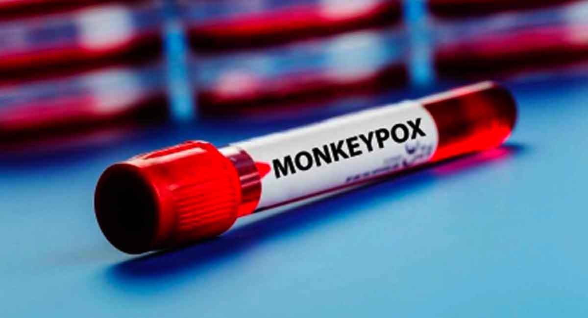 Andhra Pradesh: Suspected monkeypox case in Visakhapatnam