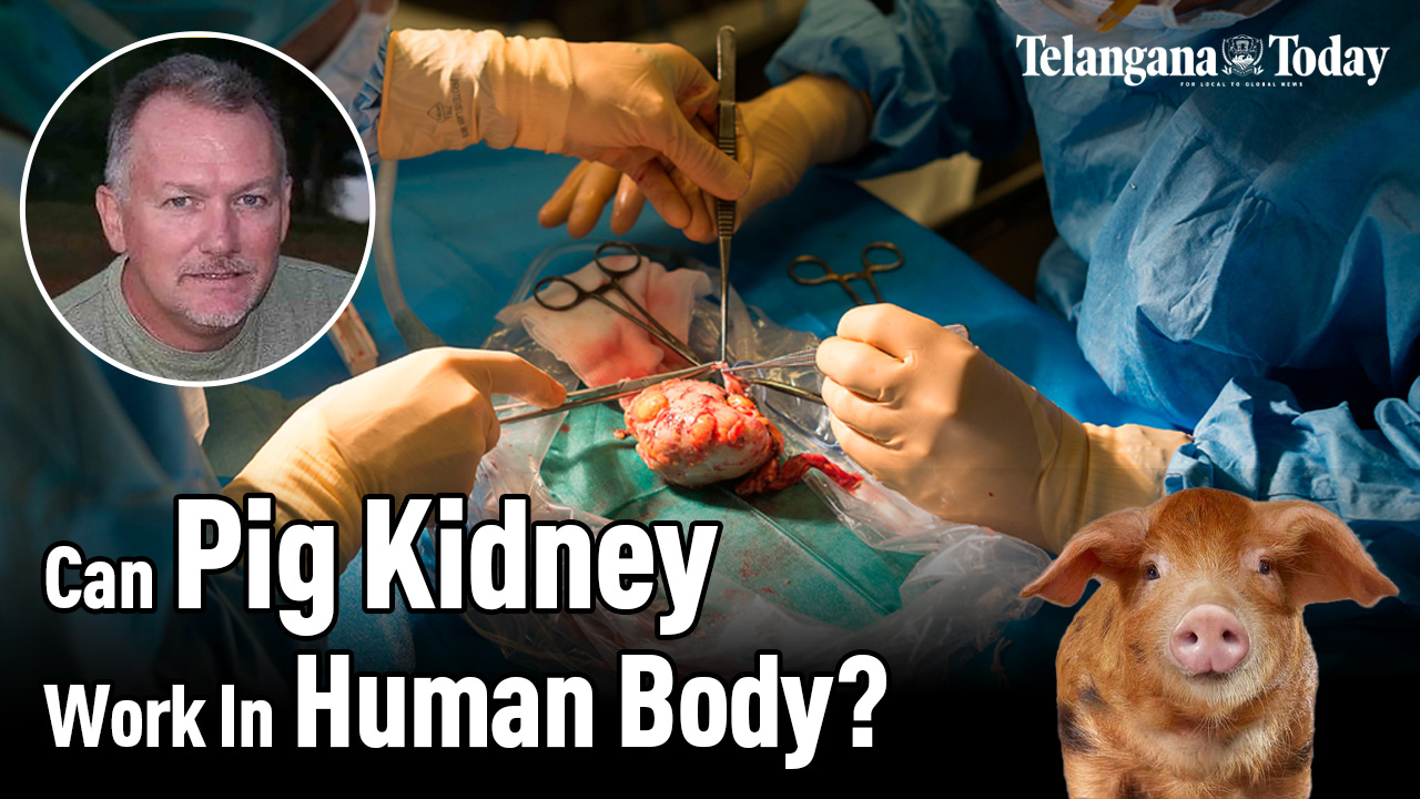 Pig Kidney Transplanted Into Human Robert Montgomery, NYU Langone