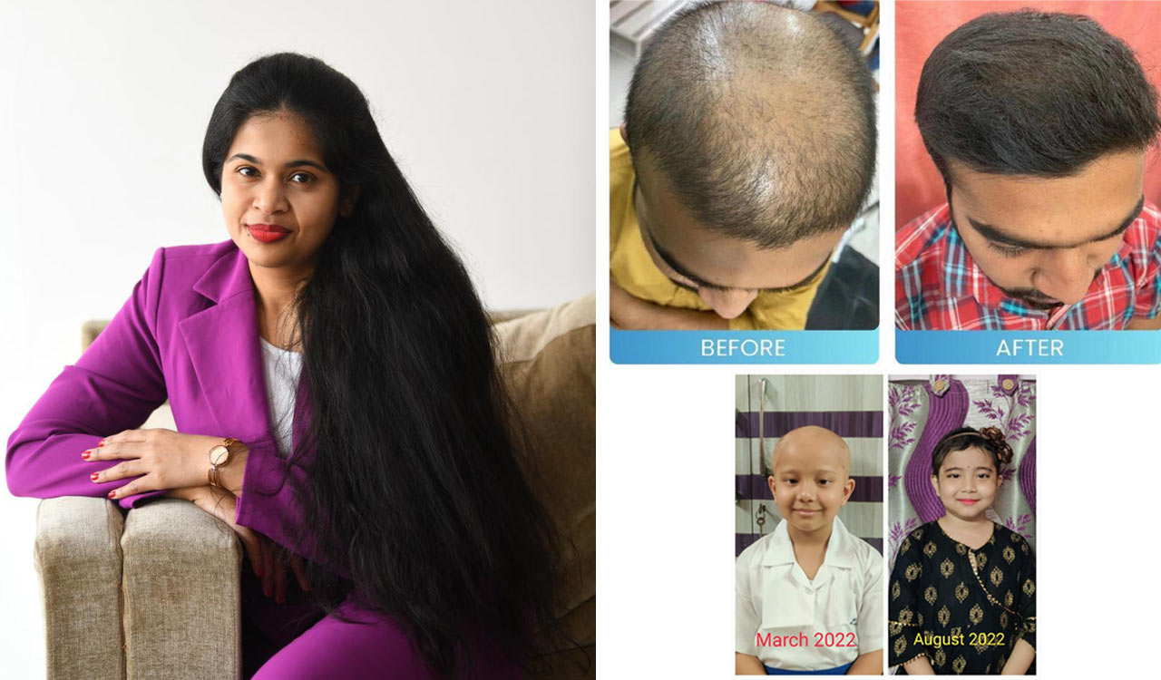 Reverse hair loss with Dr Stuti Khare Shukla’s FDA approved hair growth booster