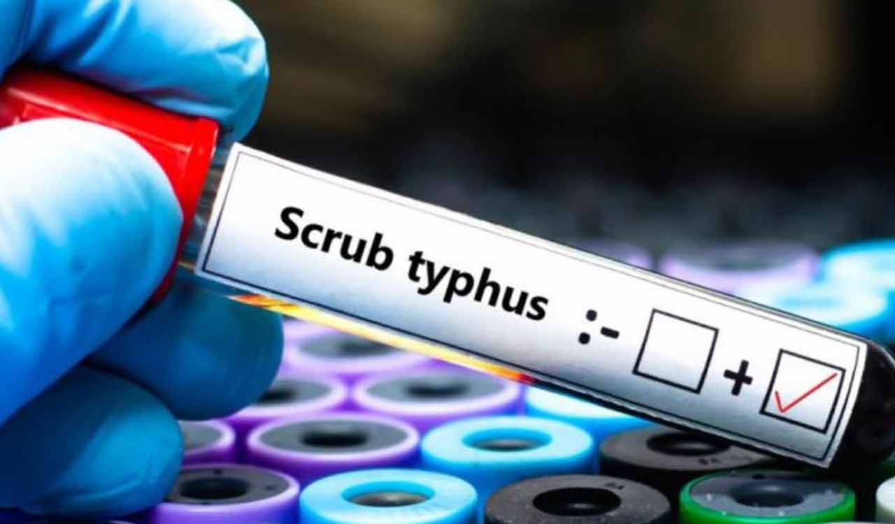 Odisha: 10 more scrub typhus cases take tally to 832   