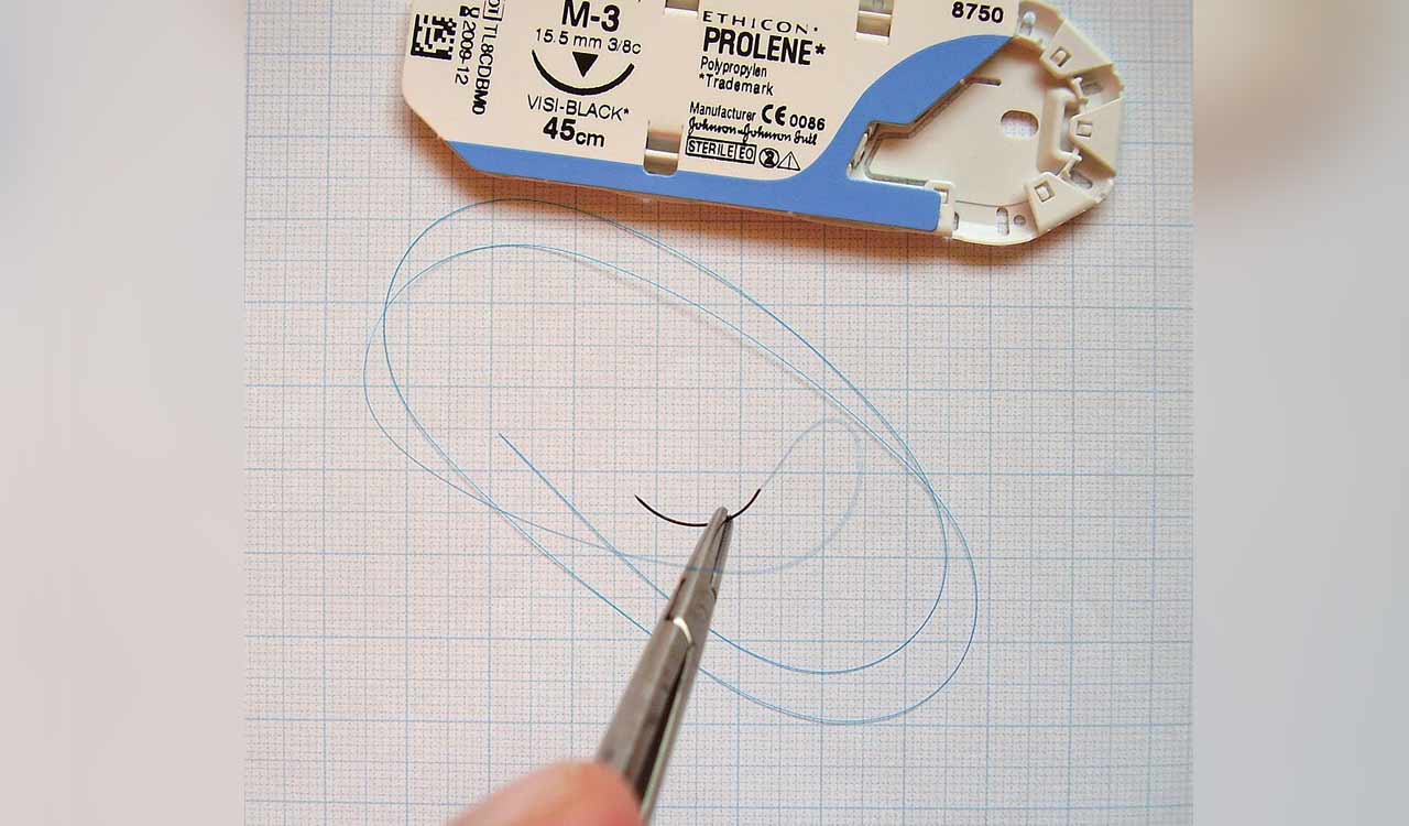 India surgical sutures market to grow to $380 mn in 2030