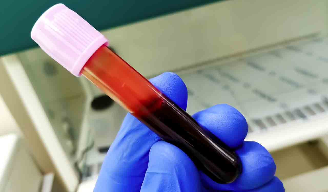Soon, blood test can detect breast cancer!